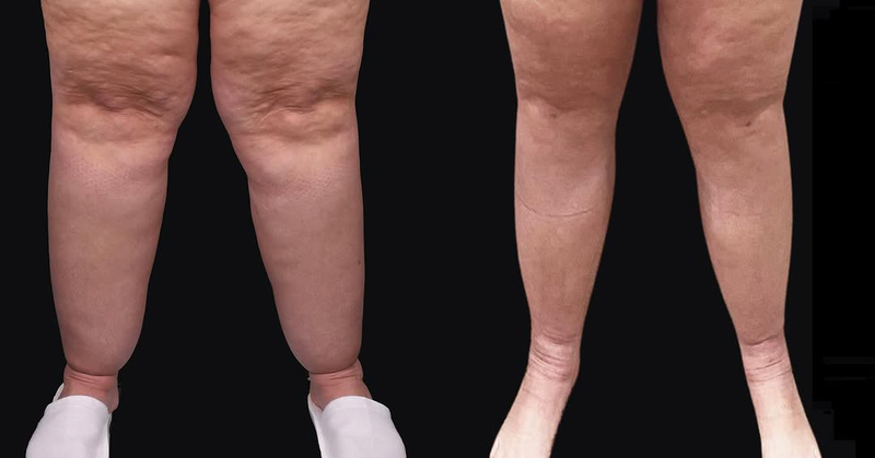 b&a5.png